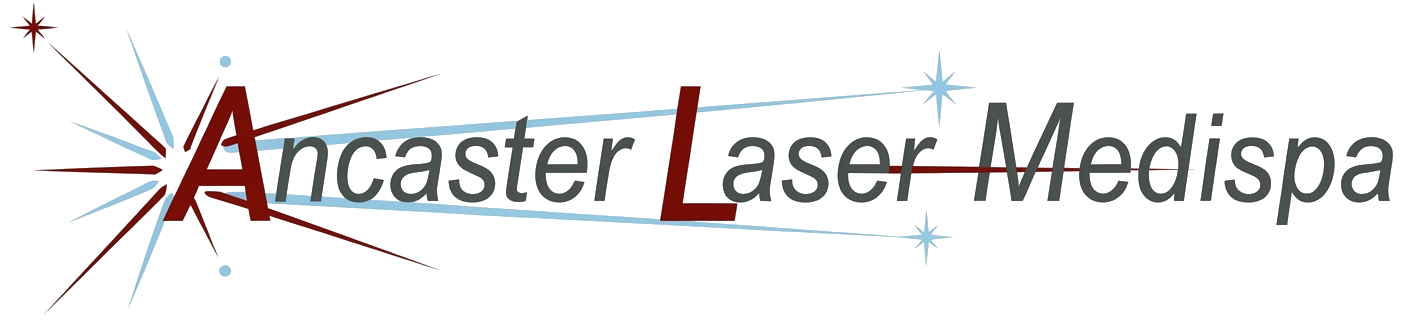 Ancaster Laser