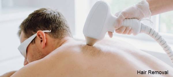 Hair Removal
